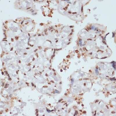 Immunohistochemistry-Paraffin: Chk1 [p Ser280] Antibody - Azide and BSA Free [NBP3-05379]